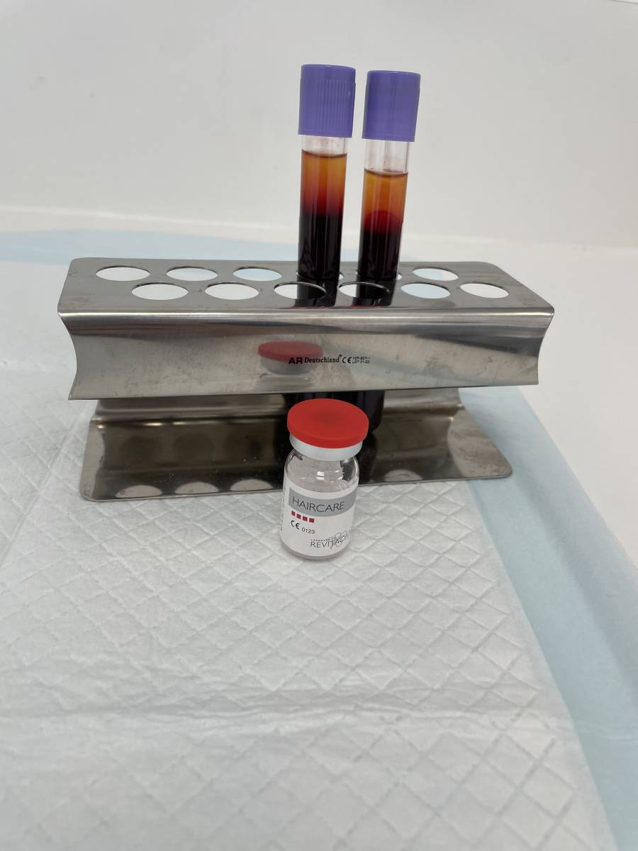 Tubes de PRF centrifugés