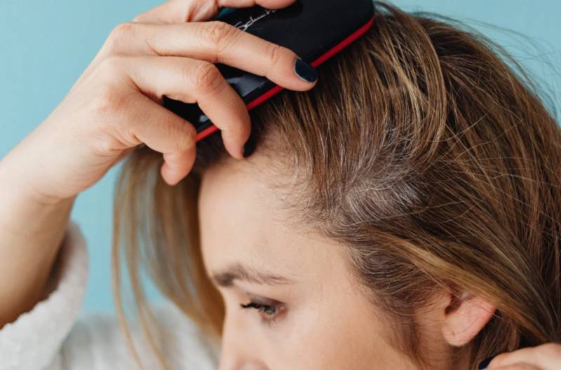 Perte de cheveux : Ce que votre cuir chevelu révèle avant tout traitement