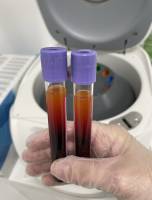 Nos prestations sur le secteur de près d'Aix-en-Provence et les Bouches-du-Rhône