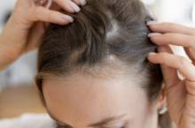 Notre zone d'activité pour ce service Réaliser un tatouage capillaire semi-permanente sur les zones clairsemées de vos cheveux vers Vitrolles proche de Martigues : prenez RDV en ligne