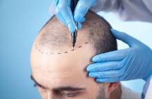 Notre zone d'activité pour ce service Où réaliser des injections de PRP ou PRF efficaces pour stimuler la pousse des cheveux à petits prix