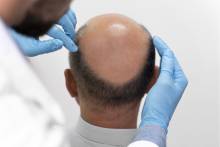 Notre zone d'activité pour ce service Spécialiste du cheveu pour réaliser un diagnostic capillaire et évaluer la santé de vos cheveux