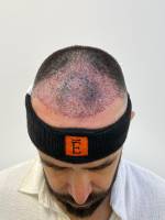 Nos prestations sur le secteur de à Marseille et les Bouches-du-Rhône (13)